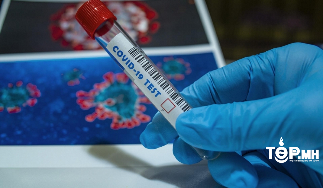 Улсын хэмжээнд КОВИД-19-ийн 167 тохиолдол батлагдлаа