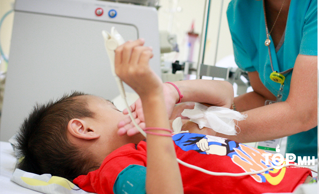 Амбулаторийн үзлэгийн 5.8 хувийг томуу,томуу төст өвчин эзэлж байна