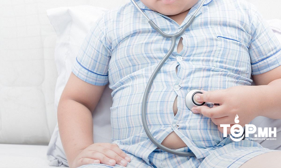 Илүүдэл жин, таргалалтад эрүүл бус хүнсний зар сурталчилгаа хүчтэй нөлөөлдөг