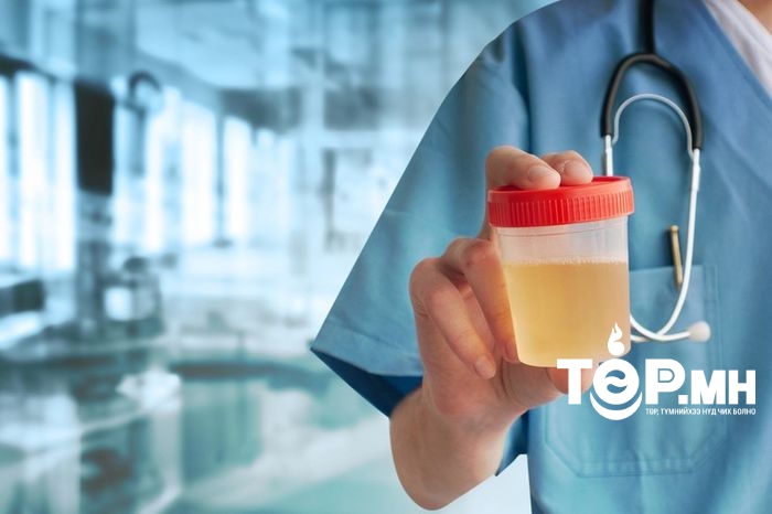 Шээс хөөх 2 төрлийн эмийг ЭМД-ын сангаас 100 хувь хөнгөлөлттэй олгож байна