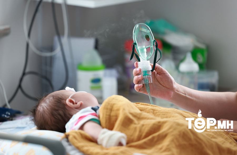 Томуу, томуу төст өвчний эдгэрэлт удаан байна