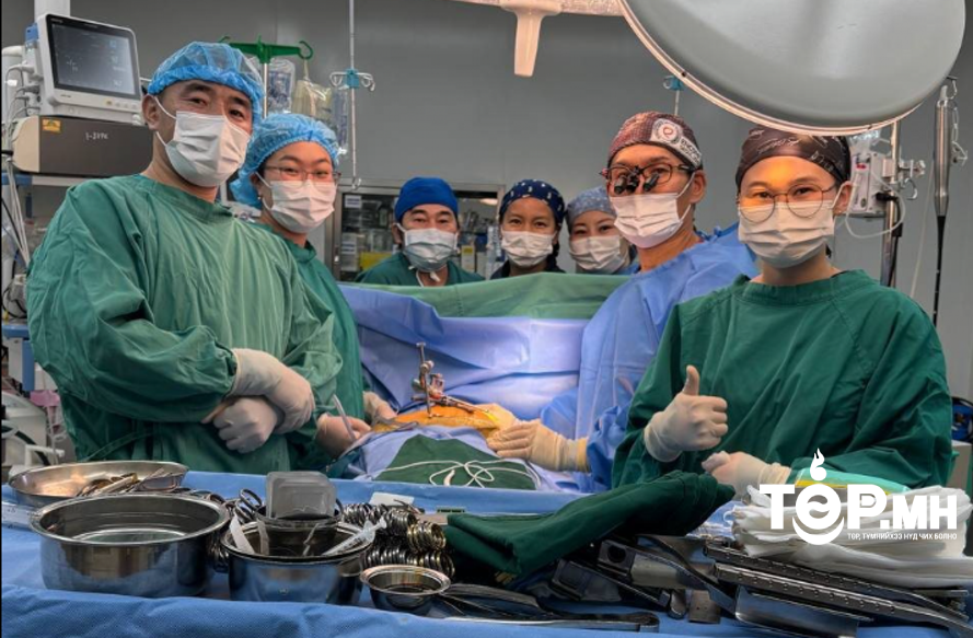 Монгол Улсад анх зүрхэнд титэм судас нөхөн сэргээх мэс заслыг амжилттай хийлээ