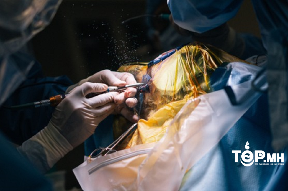 Улсын Гуравдугаар Төв Эмнэлэг уналт таталтын мэс засал эмчилгээг бие даан хийж эхлүүлээд байна