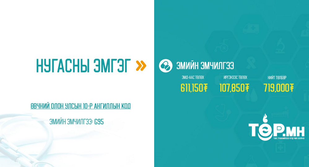 Нугасны эмгэгийн эмийн эмчилгээний 85 хувийг ЭМД-ын сангаас хөнгөлнө