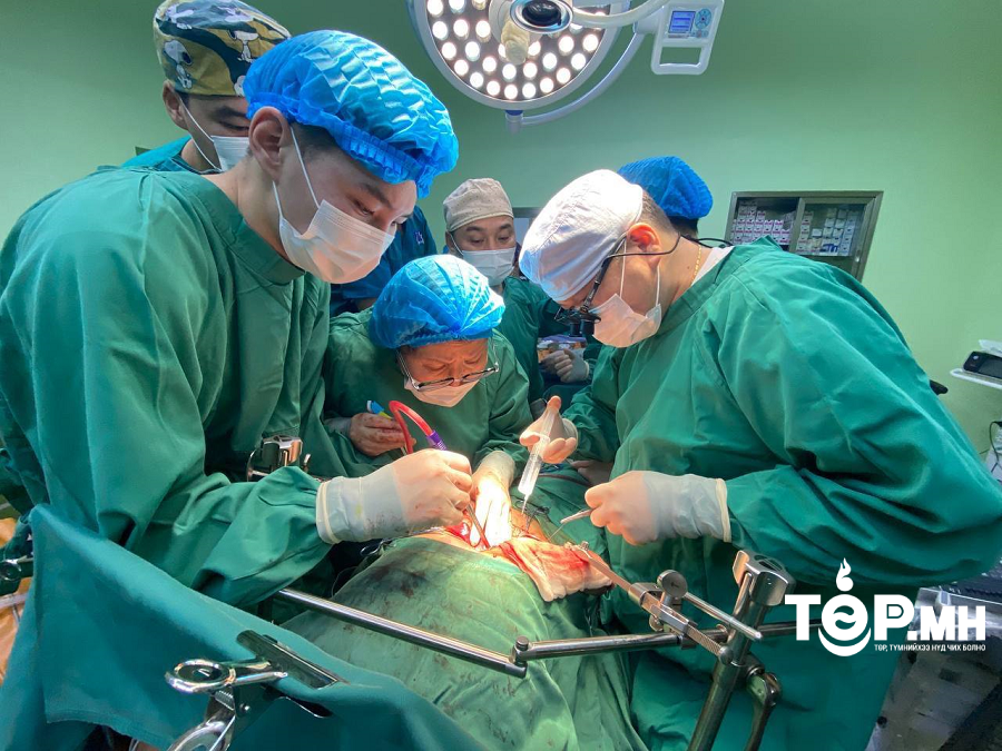 УГТЭ: Хавдрын мэс заслын тусламж үйлчилгээг өргөжүүлж, төвлөрлийг сааруулна