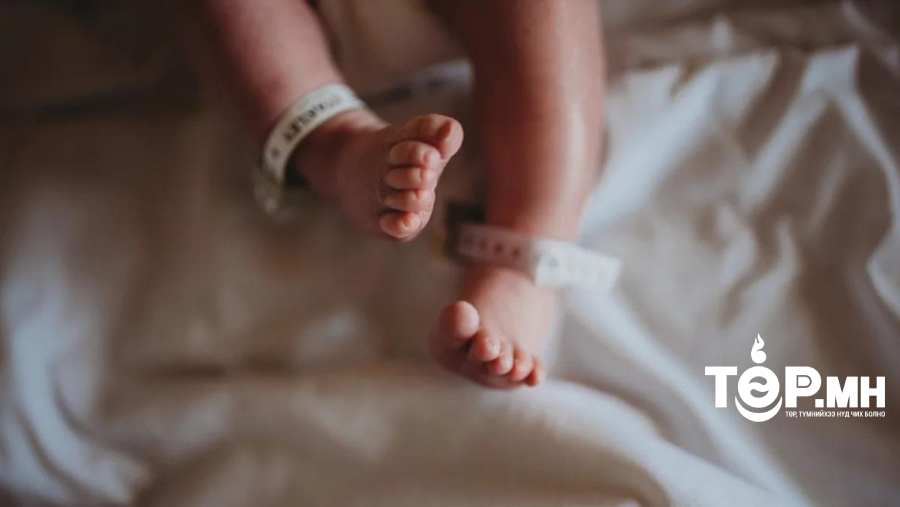 Монгол Улсад 0-5 хүртэлх насны хүүхдийн эндэгдлийн 64 хувийг нярайн эндэгдэл дангаар эзэлж байна